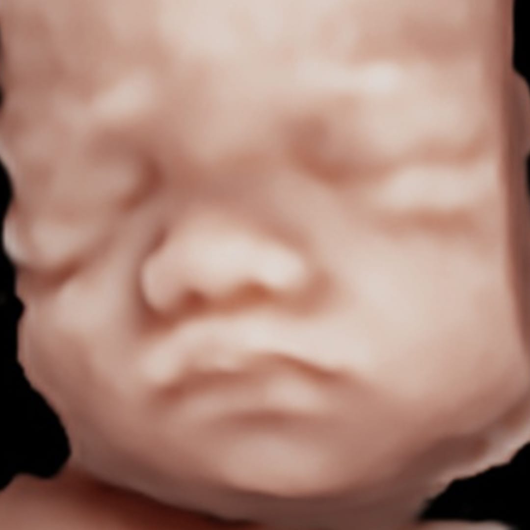 Before image