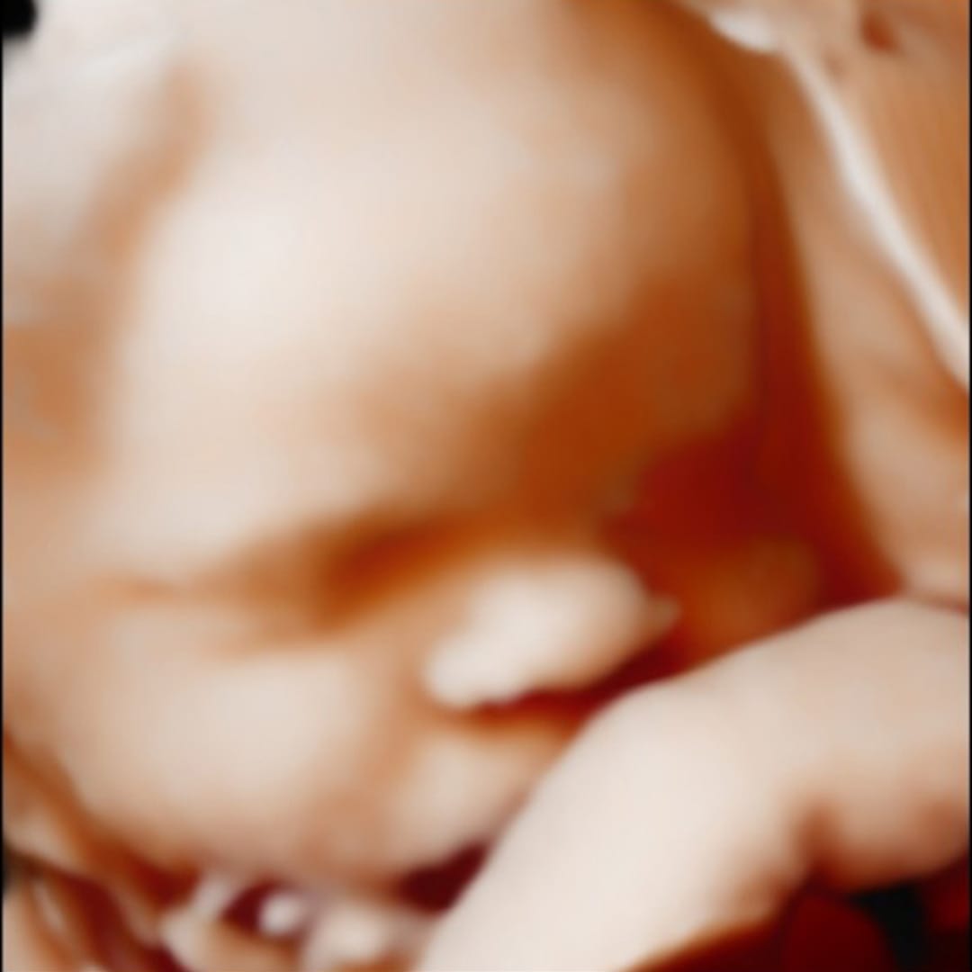 Before image