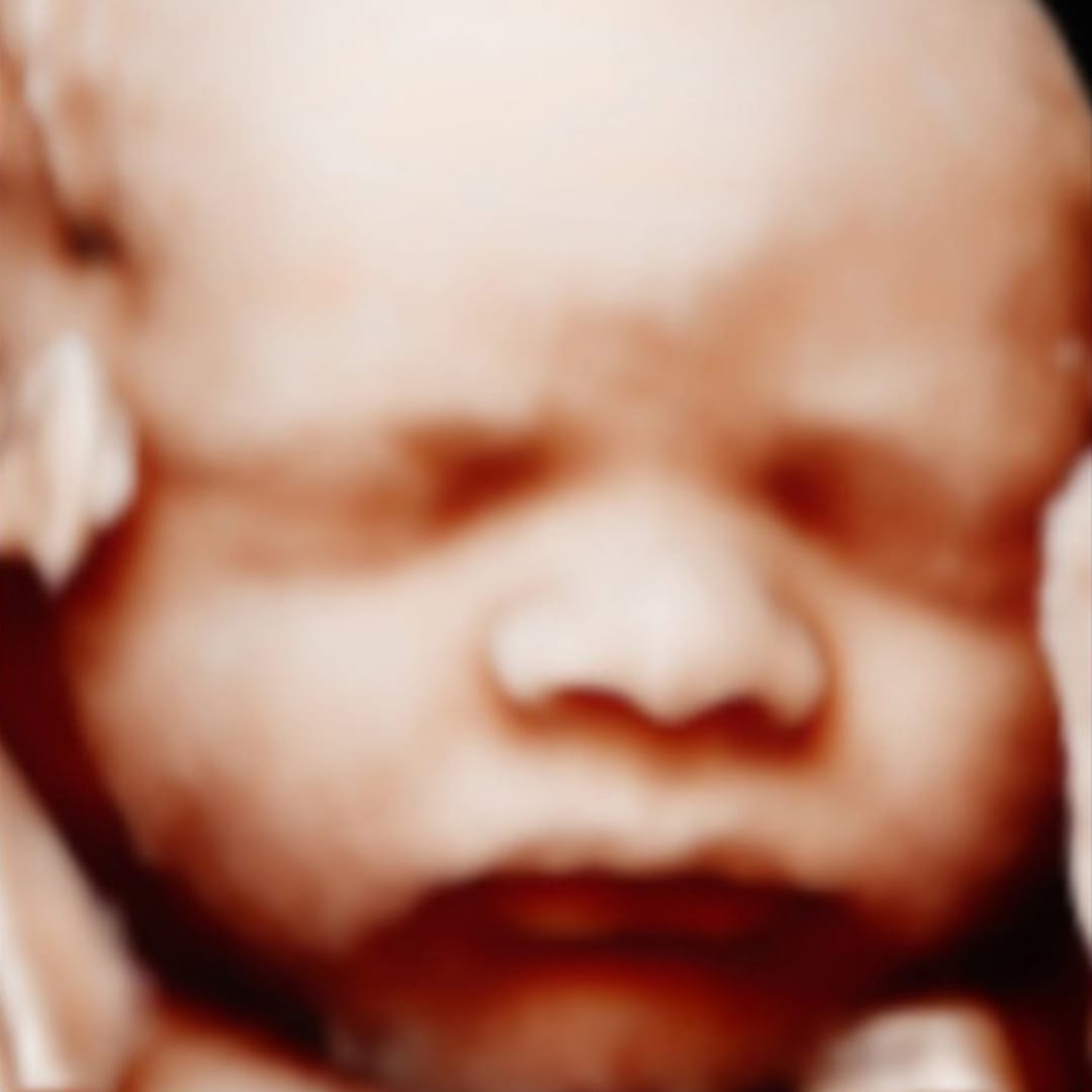 Before image