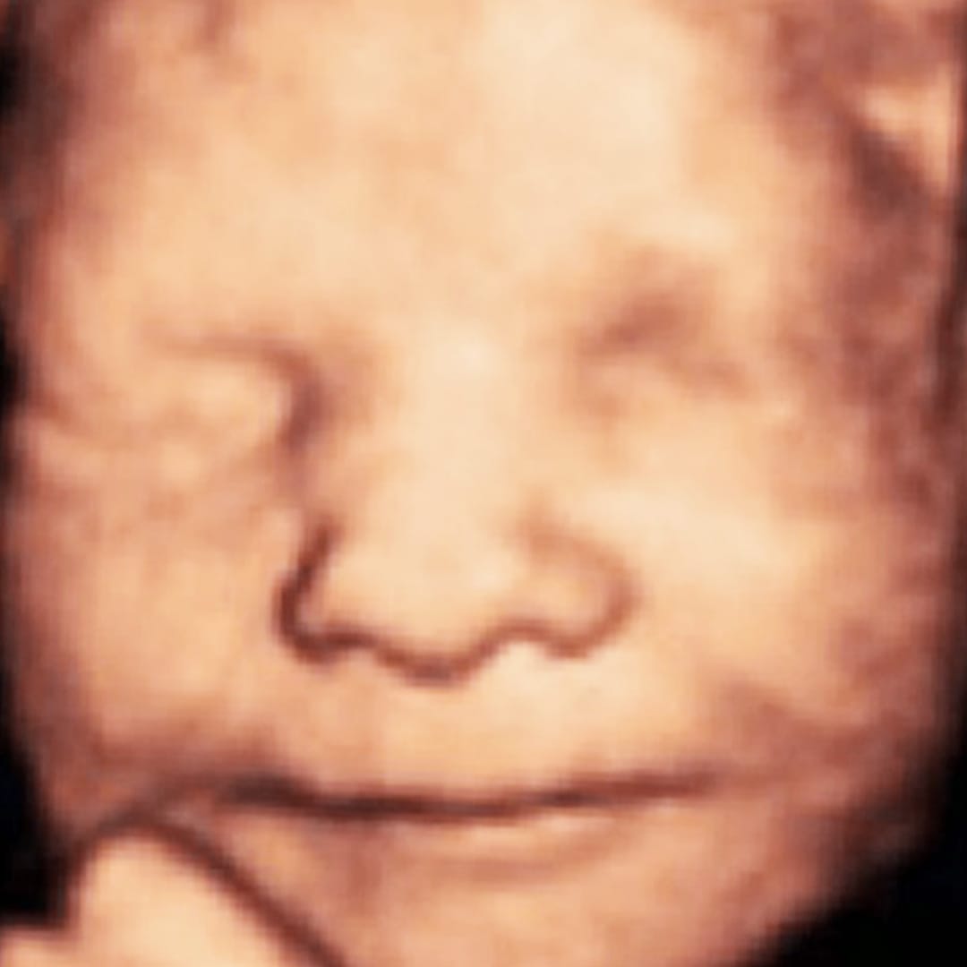 Before image